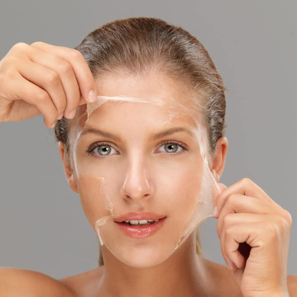 Chemical Peels